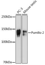 PUM2 Antibody in Western Blot (WB)