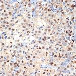 Cdc40 Antibody in Immunohistochemistry (Paraffin) (IHC (P))