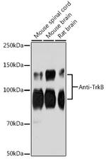 TrkB Antibody in Western Blot (WB)