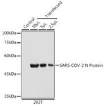 SARS-CoV-2 Nucleocapsid Antibody in Western Blot (WB)