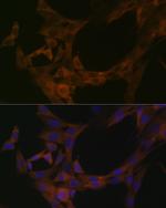 STK39 Antibody in Immunocytochemistry (ICC/IF)