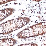 STK39 Antibody in Immunohistochemistry (Paraffin) (IHC (P))