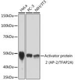 AP2 alpha Antibody in Western Blot (WB)