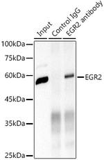 EGR2 Antibody in Immunoprecipitation (IP)