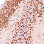 H-cadherin Antibody in Immunohistochemistry (Paraffin) (IHC (P))