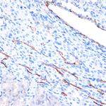 H-cadherin Antibody in Immunohistochemistry (Paraffin) (IHC (P))