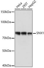 SNX1 Antibody in Western Blot (WB)