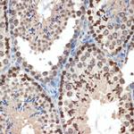 eIF3e Antibody in Immunohistochemistry (Paraffin) (IHC (P))