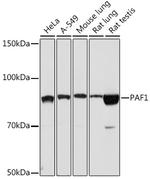 PAF1 Antibody in Western Blot (WB)