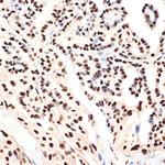 PHAPI2 Antibody in Immunohistochemistry (Paraffin) (IHC (P))