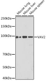 VAV2 Antibody in Western Blot (WB)