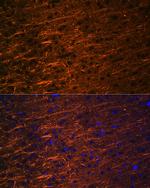 alpha Internexin Antibody in Immunohistochemistry (Paraffin) (IHC (P))