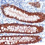 Galectin 4 Antibody in Immunohistochemistry (Paraffin) (IHC (P))