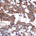 Galectin 4 Antibody in Immunohistochemistry (Paraffin) (IHC (P))