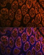 Galectin 4 Antibody in Immunohistochemistry (Paraffin) (IHC (P))