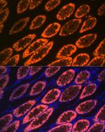 Galectin 4 Antibody in Immunohistochemistry (Paraffin) (IHC (P))