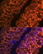 Galectin 4 Antibody in Immunohistochemistry (Paraffin) (IHC (P))