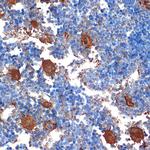 PF4 Antibody in Immunohistochemistry (Paraffin) (IHC (P))