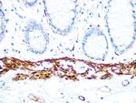 Calponin 1 Antibody in Immunohistochemistry (Paraffin) (IHC (P))