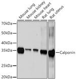 Calponin 1 Antibody in Western Blot (WB)