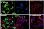 Desmin Antibody in Immunocytochemistry (ICC/IF)