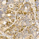 Thioredoxin 1 Antibody in Immunohistochemistry (Paraffin) (IHC (P))