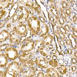 Thioredoxin 1 Antibody in Immunohistochemistry (Paraffin) (IHC (P))