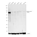 Prolactin Receptor Antibody