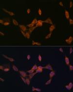 PMP70 Antibody in Immunocytochemistry (ICC/IF)