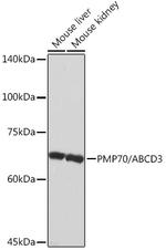 PMP70 Antibody in Western Blot (WB)