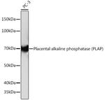 Placental Alkaline Phosphatase Antibody in Western Blot (WB)