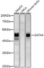 GATA4 Antibody in Western Blot (WB)