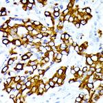 Cytokeratin 7 Antibody in Immunohistochemistry (Paraffin) (IHC (P))