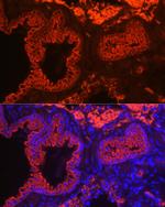 Cytokeratin 7 Antibody in Immunohistochemistry (Paraffin) (IHC (P))