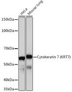 Cytokeratin 7 Antibody in Western Blot (WB)