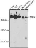 PRP8 Antibody in Western Blot (WB)