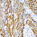 Cytokeratin 6 Antibody in Immunohistochemistry (Paraffin) (IHC (P))