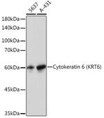 Cytokeratin 6 Antibody in Western Blot (WB)