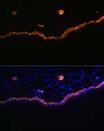 Cytokeratin 15 Antibody in Immunohistochemistry (Paraffin) (IHC (P))