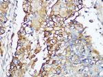 Carbonic Anhydrase IX Antibody in Immunohistochemistry (Paraffin) (IHC (P))