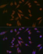 PAR4 Antibody in Immunocytochemistry (ICC/IF)