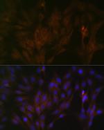 15-PGDH Antibody in Immunocytochemistry (ICC/IF)