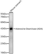 Adenosine Deaminase Antibody in Western Blot (WB)