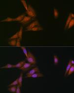 p23 Antibody in Immunocytochemistry (ICC/IF)