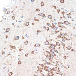 ADORA1 Antibody in Immunohistochemistry (Paraffin) (IHC (P))