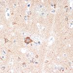 ADORA1 Antibody in Immunohistochemistry (Paraffin) (IHC (P))