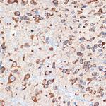 ADORA1 Antibody in Immunohistochemistry (Paraffin) (IHC (P))