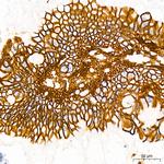 CDH17 Antibody in Immunohistochemistry (Paraffin) (IHC (P))