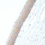 CRABP1 Antibody in Immunohistochemistry (Paraffin) (IHC (P))