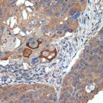 CRABP1 Antibody in Immunohistochemistry (Paraffin) (IHC (P))